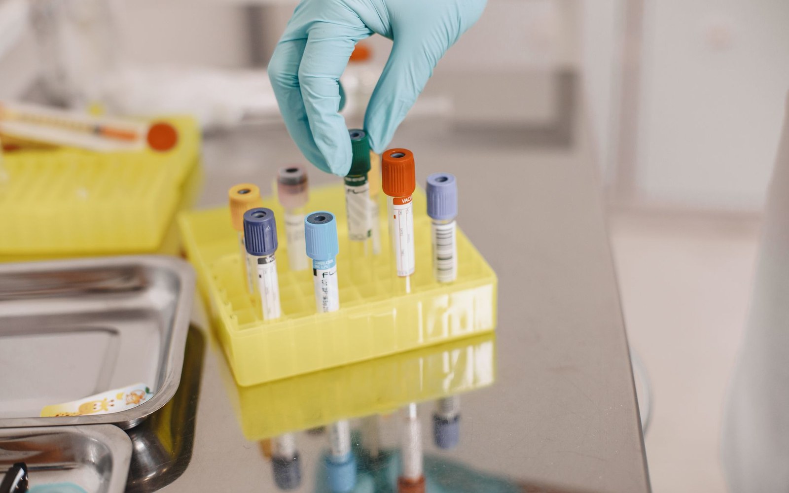 A gloved hand picks a blood sample tube from a yellow rack on a lab counter