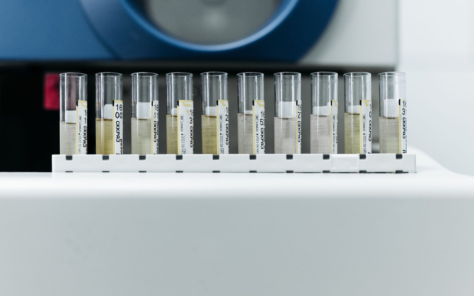 Row of labeled test tubes in a rack ready for laboratory analysis